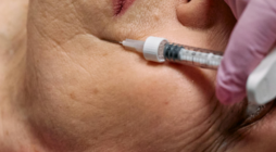 The Benefits of Botox for Preventing Fine Lines and Wrinkles