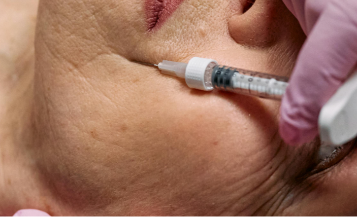 The Benefits of Botox for Preventing Fine Lines and Wrinkles