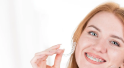 Common Retainer Problems and How to Solve Them