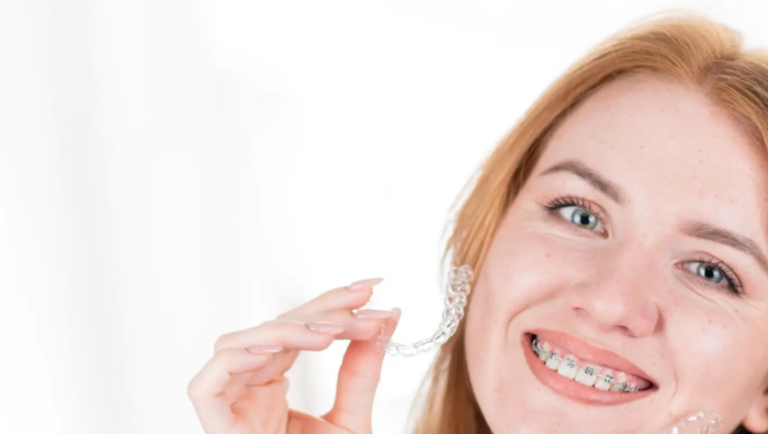 Common Retainer Problems and How to Solve Them